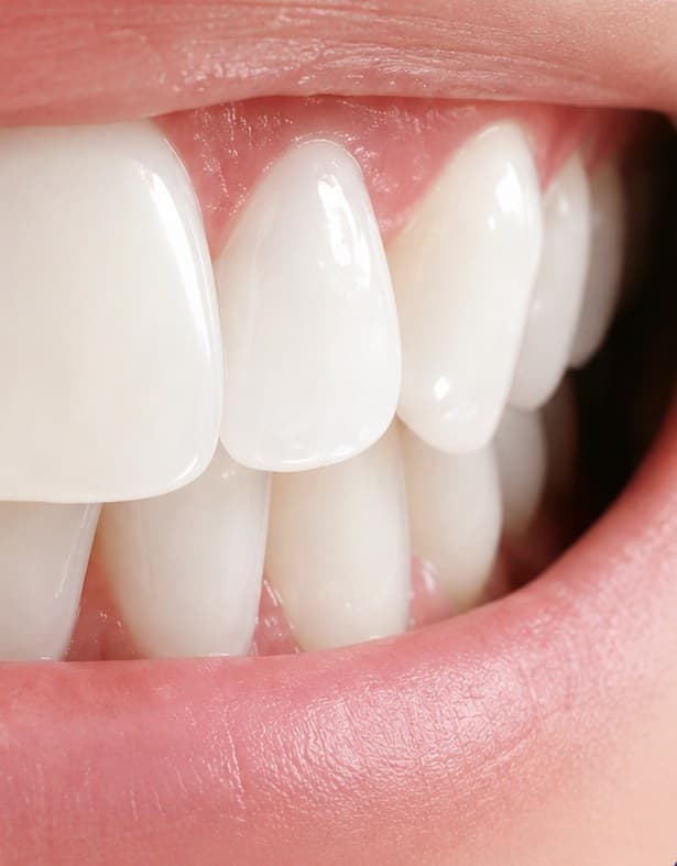 Sarah, 24, NYC after using PURPL strips