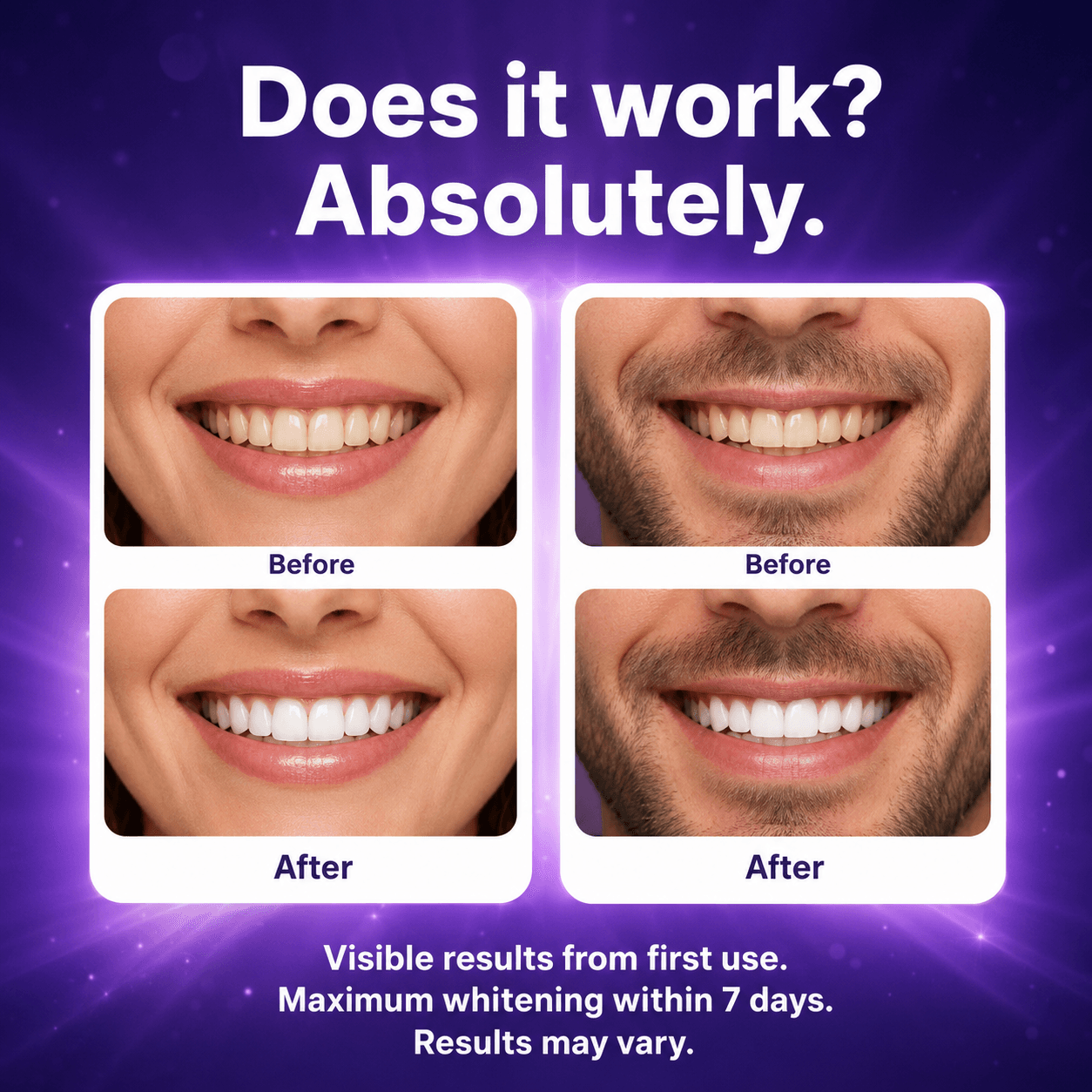 PURPL whitening strips
