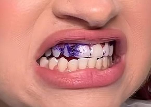 Customer result